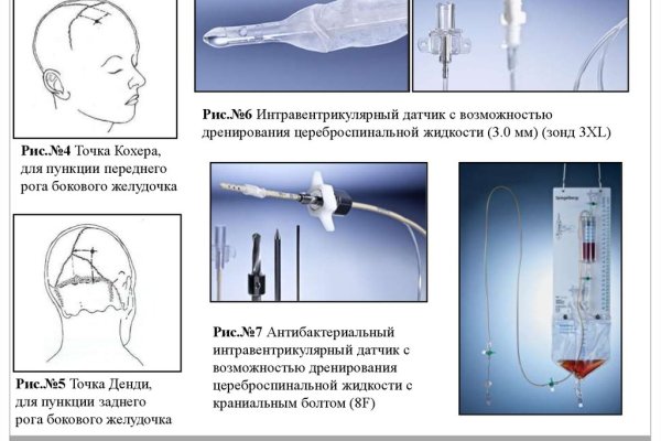 Кракен нрк